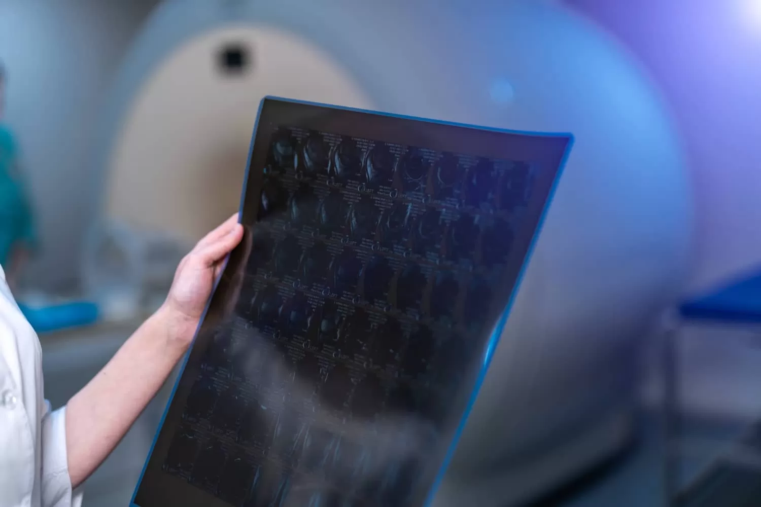 КТ верхних конечностей-5