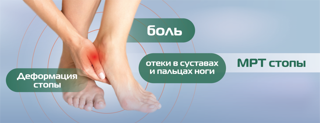 МРТ_нижние конечности, стопа(БЕЗ ЦЕНЫ) (3).png